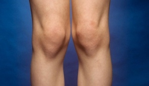 OPTM Health Care - Knee Symmetry